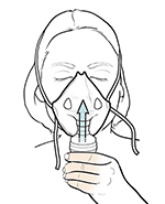 Une femme inhalant des médicaments à travers un masque facial de nébulisation.